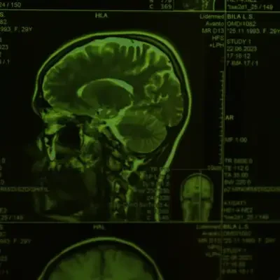 Traumatic brain injury legal representation for Massachusetts personal injury cases
